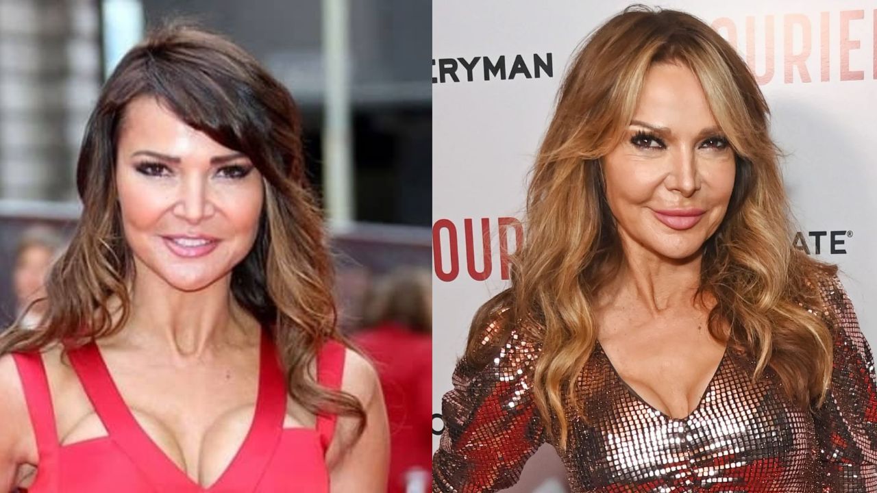Lizzie Cundy's Plastic Surgery: What Procedure Has the Former WAG Had?