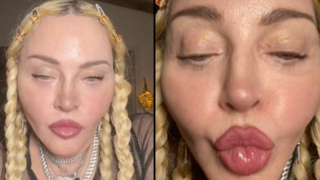 Madonna's Plastic Surgery: A Tiktok Video of The Singer Described as Unsettling Sparked Cosmetic Surgery Rumors!