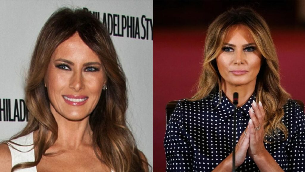 Melania Trump’s Weight Gain in 2023: Did the Former First Lady Gain Weight Because Her Health Issues?