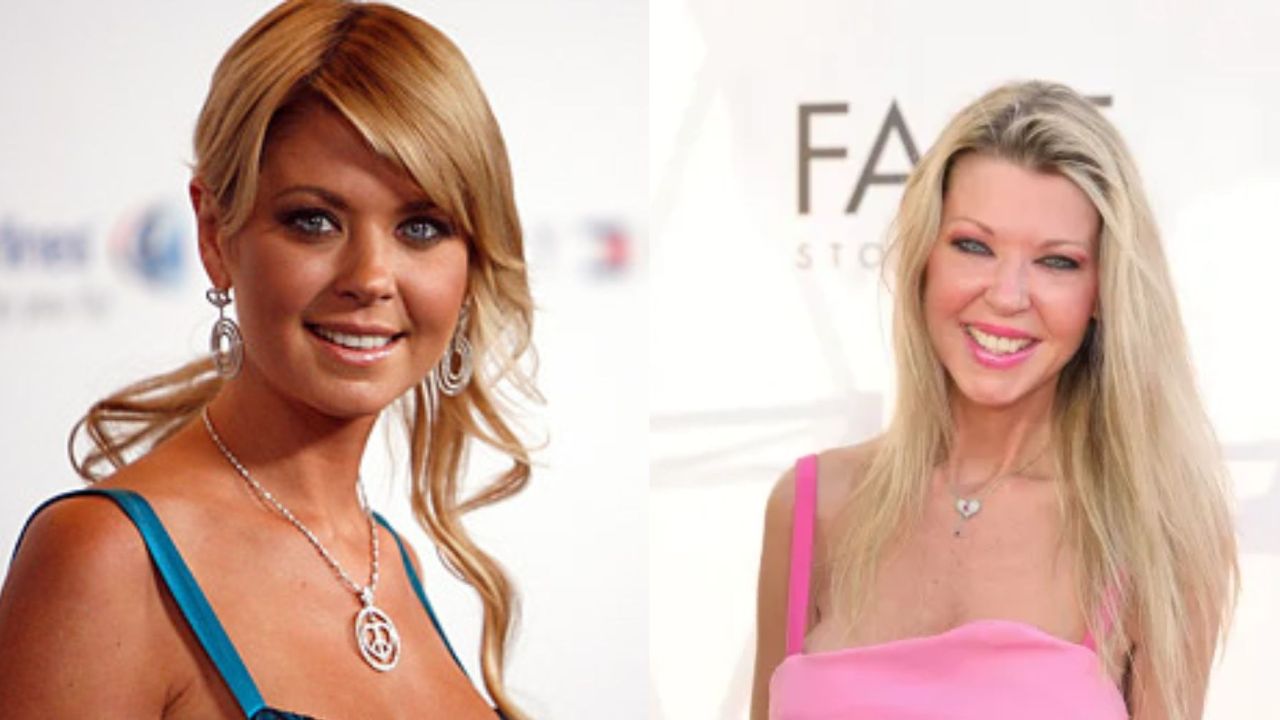 Tara Reid’s Plastic Surgery: How Does She Look Today? Here Is How the Cosmetic Treatments Ruined Her Career!