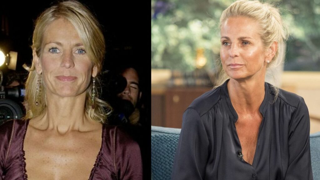 Ulrika Jonsson's Plastic Surgery: What Does the Celebrity Big Brother Winner Think About Fillers and Botox?
