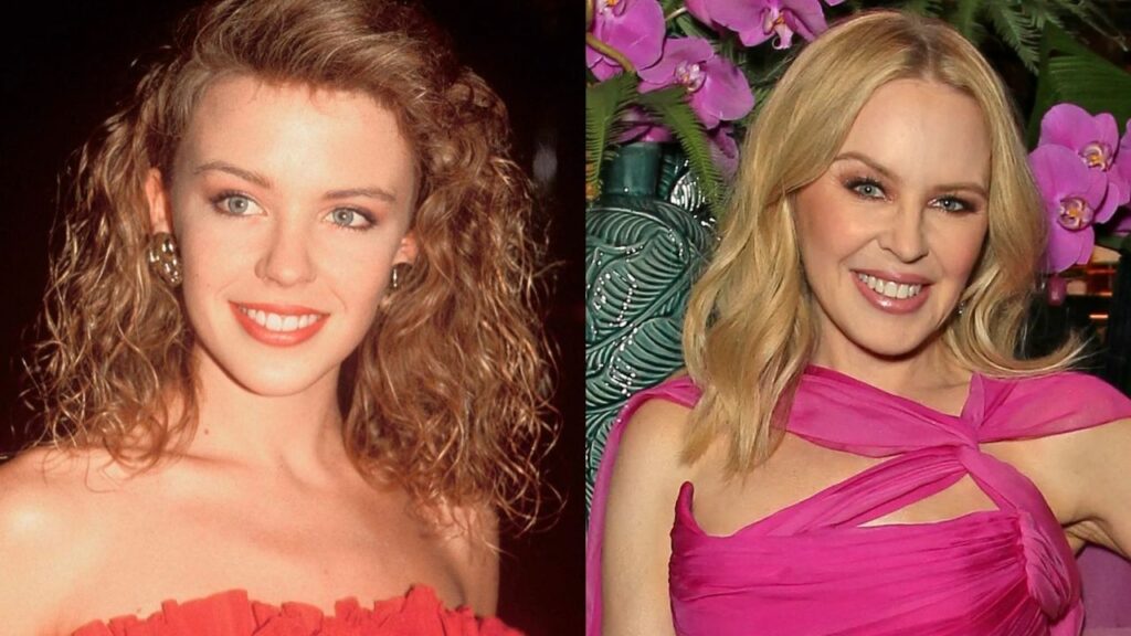 Has Kylie Minogue Had Plastic Surgery? What Did The Singer Get on Her Face? Has She Had Cheek Fillers, Botox, or a Facelift?