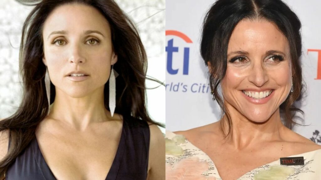 Julia Louis-Dreyfus' Plastic Surgery: Elaine Benes from Seinfeld Looks Different in You People; Fans Suspect She Has Had a Nose Job, Botox, and Fillers!