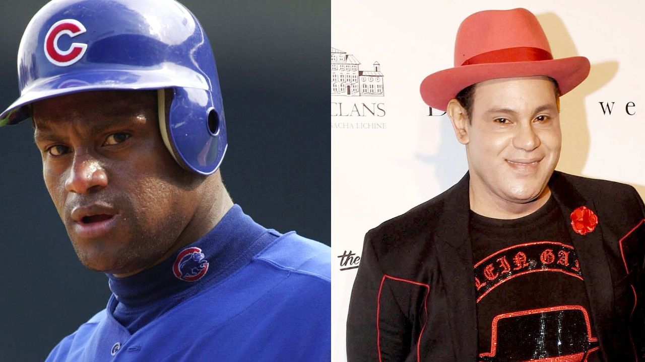 Sammy Sosa's Plastic Surgery: What Happened to the Former Cubs Icon's Skin? Does He Have Vitiligo or Is It Bleached Skin or Cosmetic Surgery?