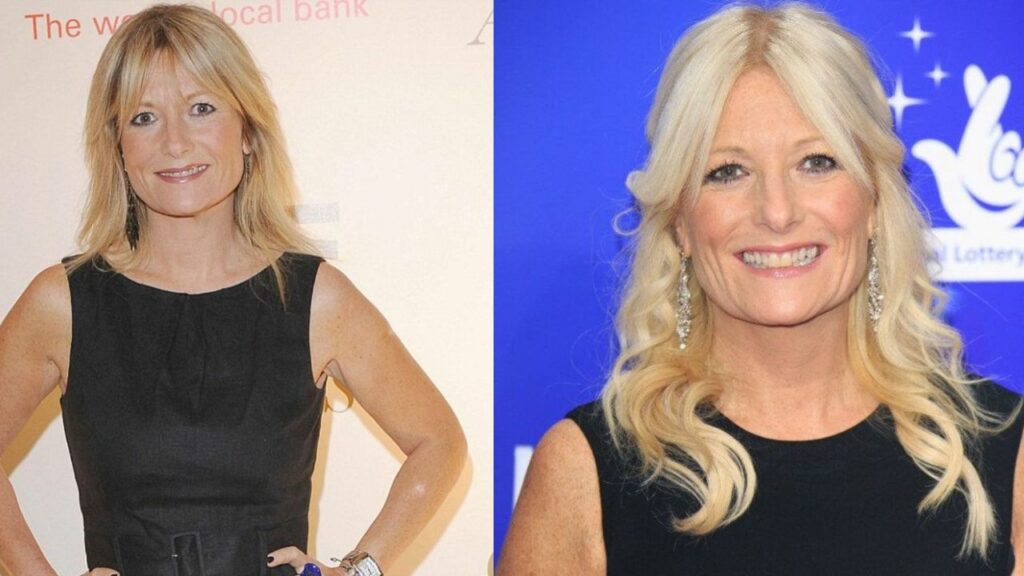 Gaby Roslin's Plastic Surgery: Her Face Has So Few Wrinkles; Did The Television Presenter Have Botox and a Facelift?