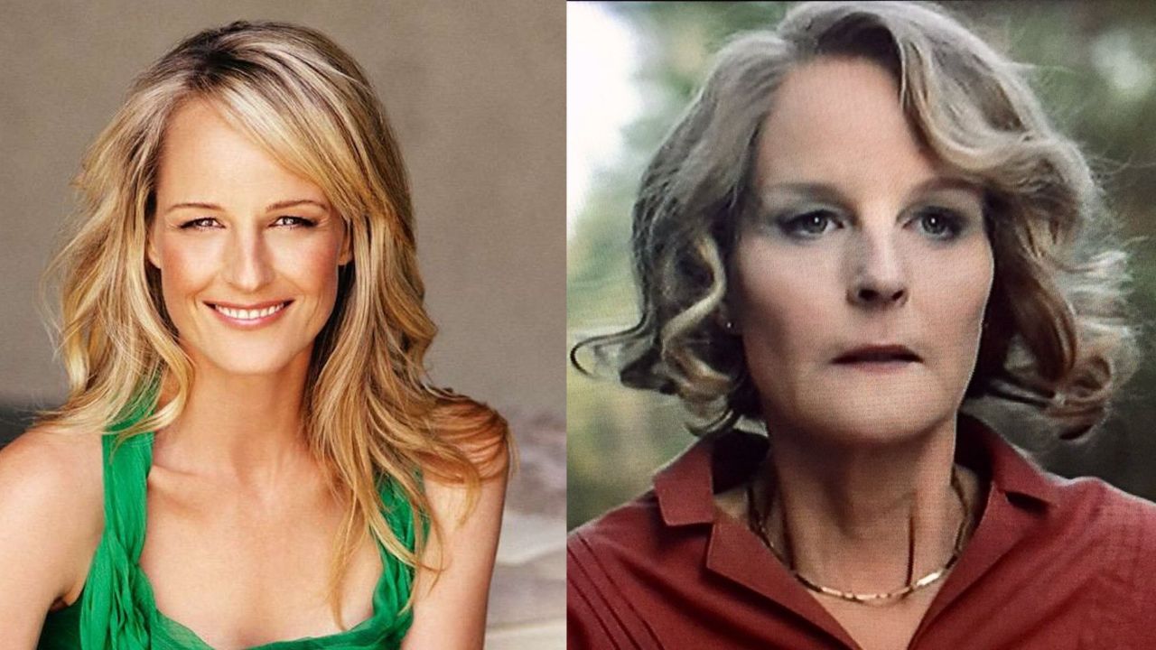 Helen Hunt's Plastic Surgery: What Happened to The I See You Star's Face? Did The World on Fire Actress Get a Bad Facelift After Her Accident? Check Out Her Before and After Cosmetic Surgery Pictures!
