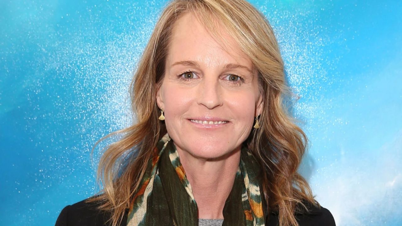 Helen Hunt looked very waxy and unnatural in World on Fire which people thought was due to bad plastic surgery.