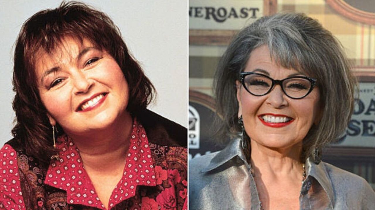 Roseanne Barr before and after plastic surgery.