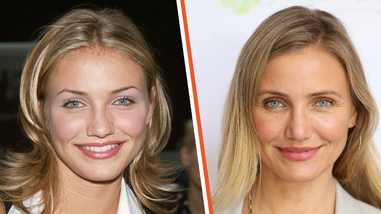Cameron Diaz before and after plastic surgery.