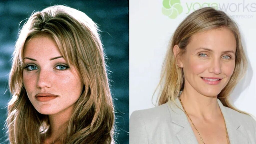 Cameron Diaz’s Plastic Surgery in 2023: Recent Photos Suggest She Looks Different Now!
