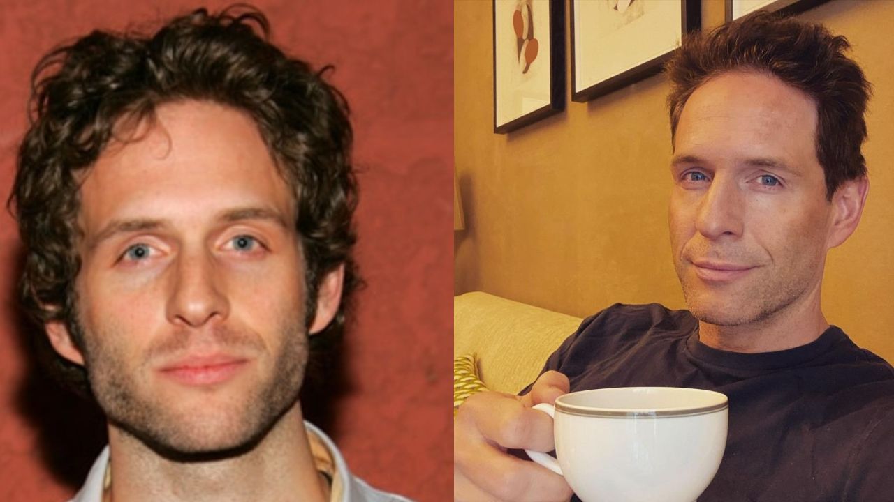 Glenn Howerton before and after plastic surgery.