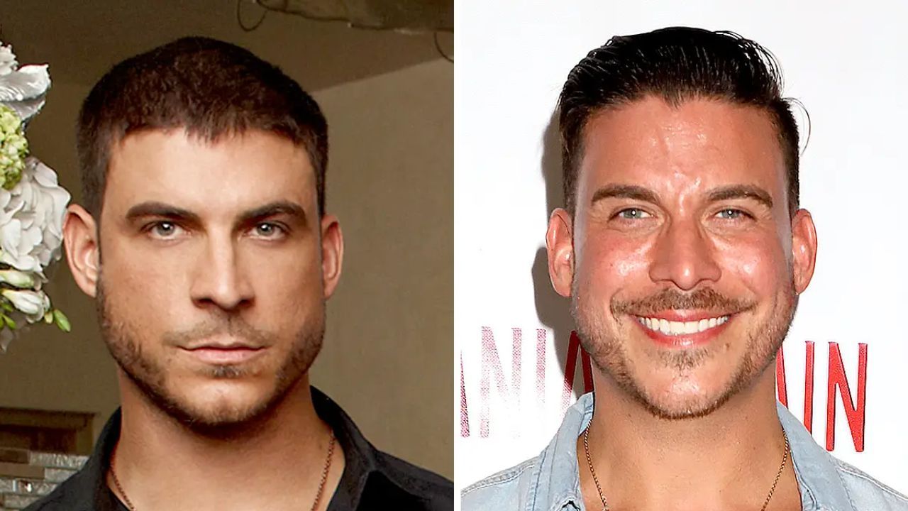 Jax Taylor before and after plastic surgery.