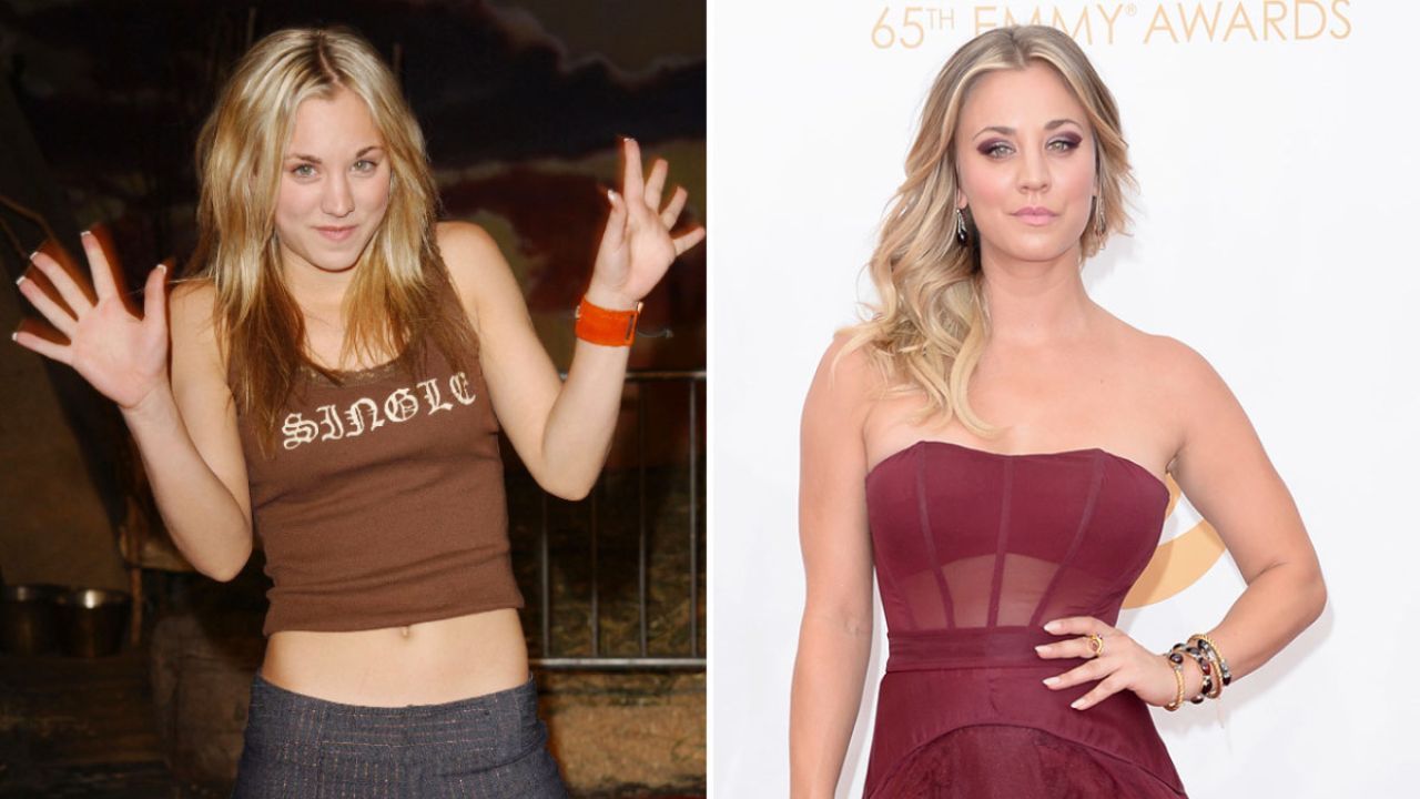Kaley Cuoco before and after plastic surgery.
