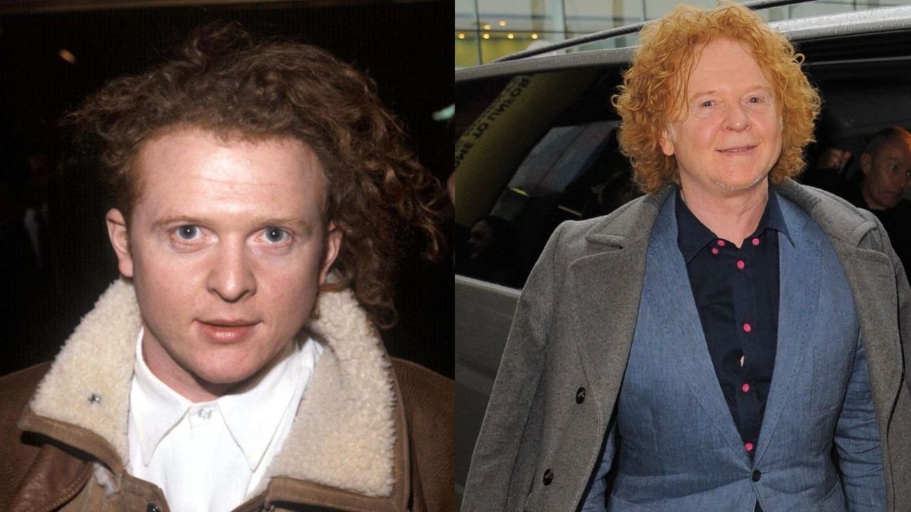 Mick Hucknall's Plastic Surgery: Is It Bad Cosmetic Surgery or Hypothyroidism?