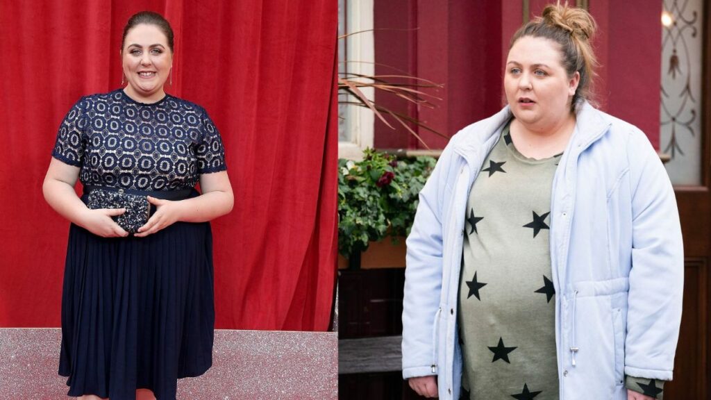 Clair Norris' Weight Loss: Gastric Band Isn't Right For Her Body!