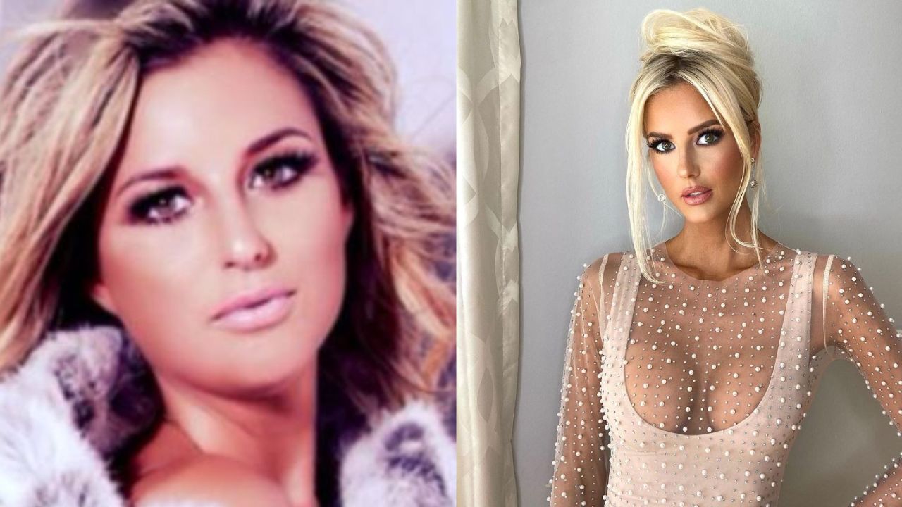 Emma Hernan’s Plastic Surgery: Her Secret to Younger Appearance? Is It Makeup? houseandwhips.com