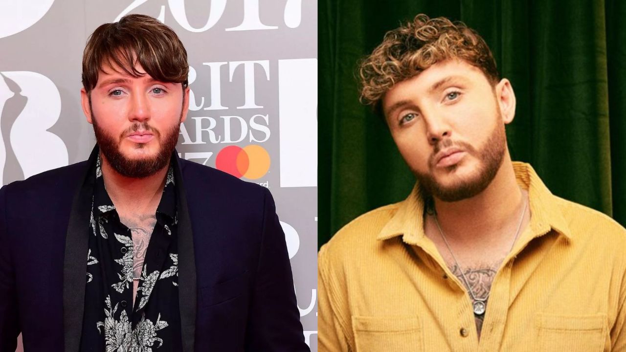 James Arthur's Plastic Surgery: Why Does His Face Look Different?
