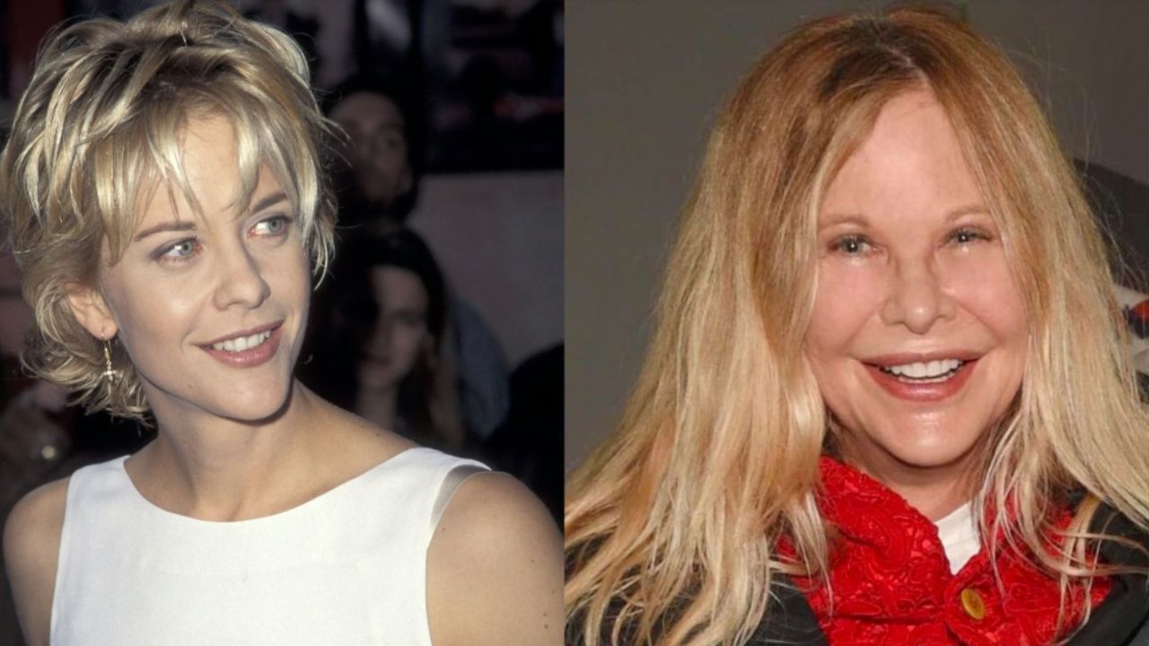 Meg Ryan before and after plastic surgery.