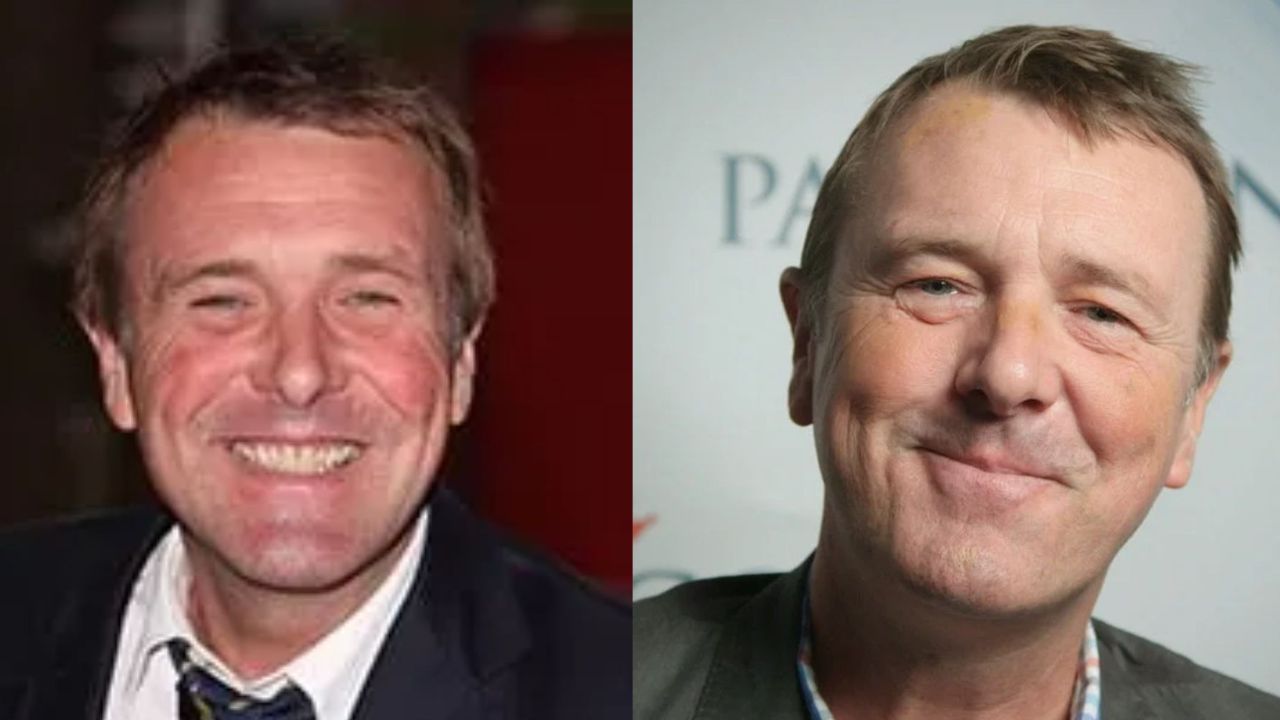 Phil Tufnell's Plastic Surgery: Has He Had Botox on His Face?