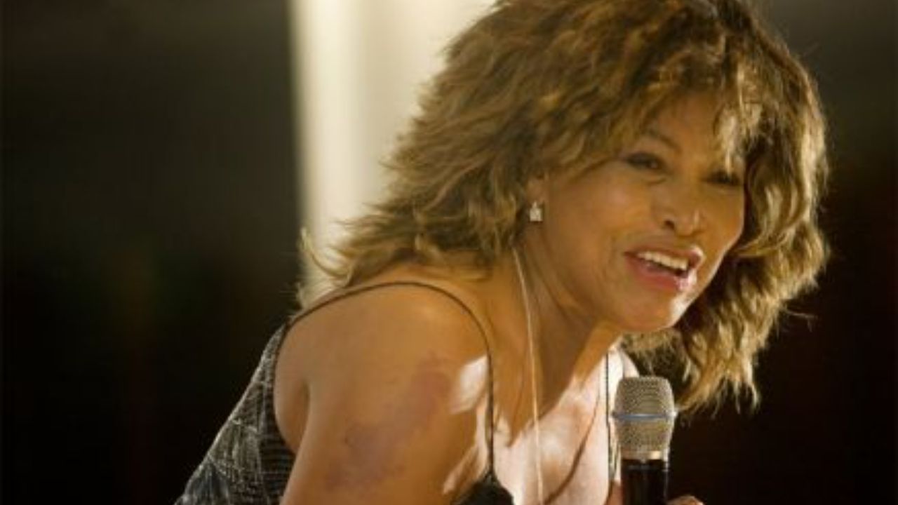 Tina Turner has a scar on her right arm some fans think she got from the third-degree burns. houseandwhips.com 