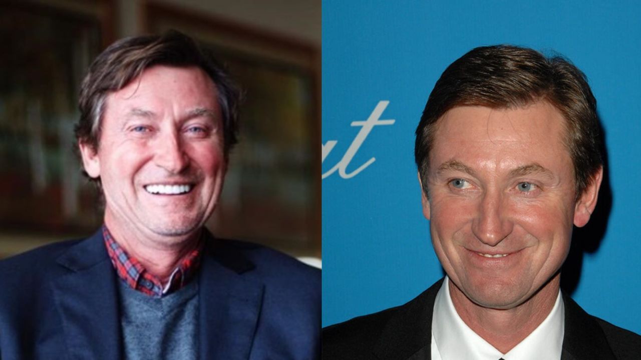 Wayne Gretzky before and after plastic surgery. houseandwhips.com