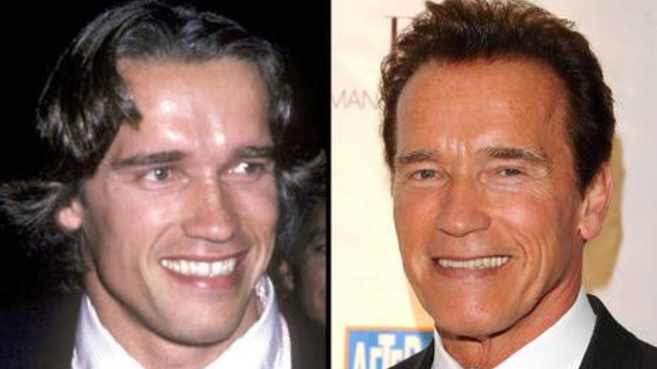 Arnold Schwarzenegger before and after plastic surgery. houseandwhips.com
