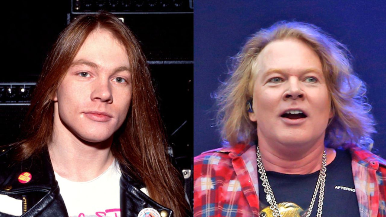 Axl Rose before and after plastic surgery. houseandwhips.com