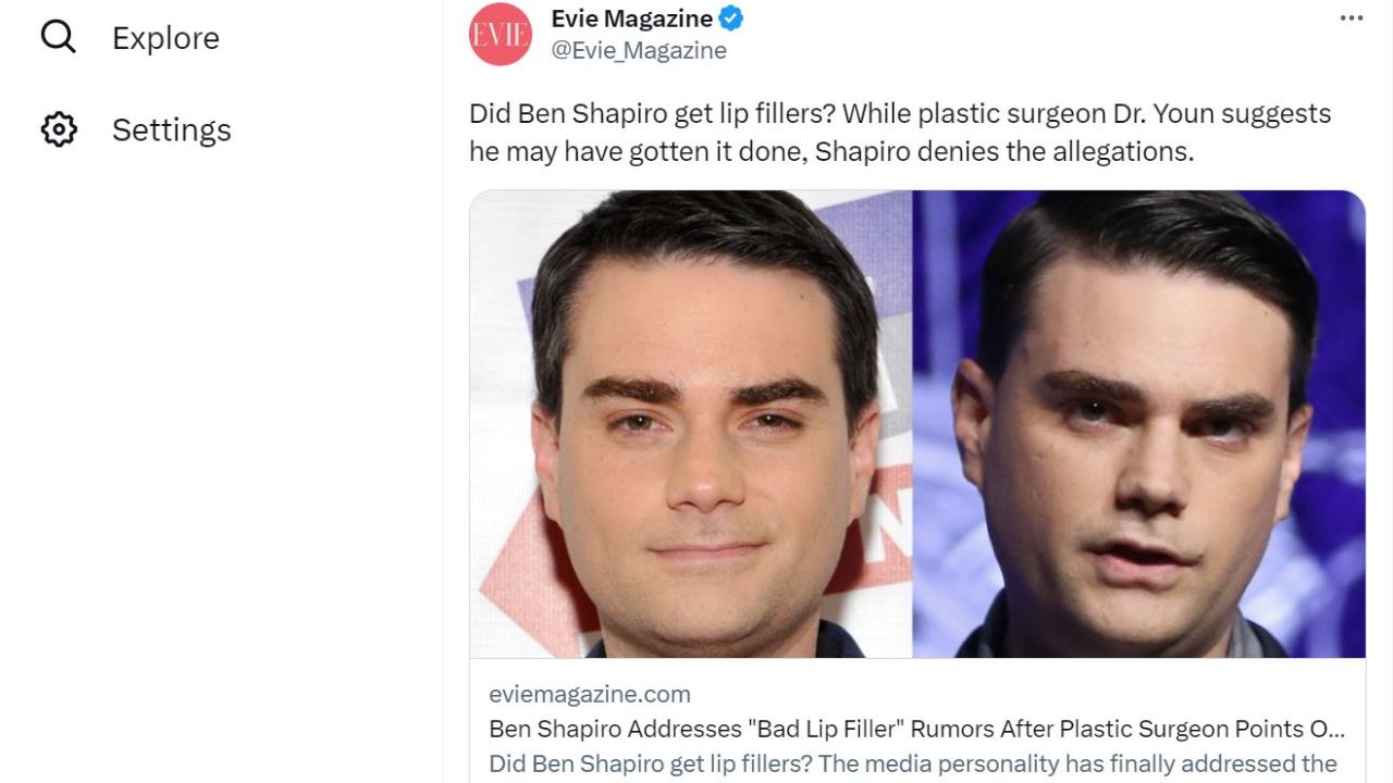 Ben Shapiro before and after plastic surgery. houseandwhips.com