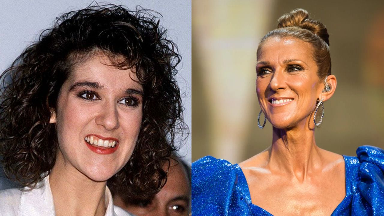 A clear change in Celine Dion's teeth. houseandwhips.com
