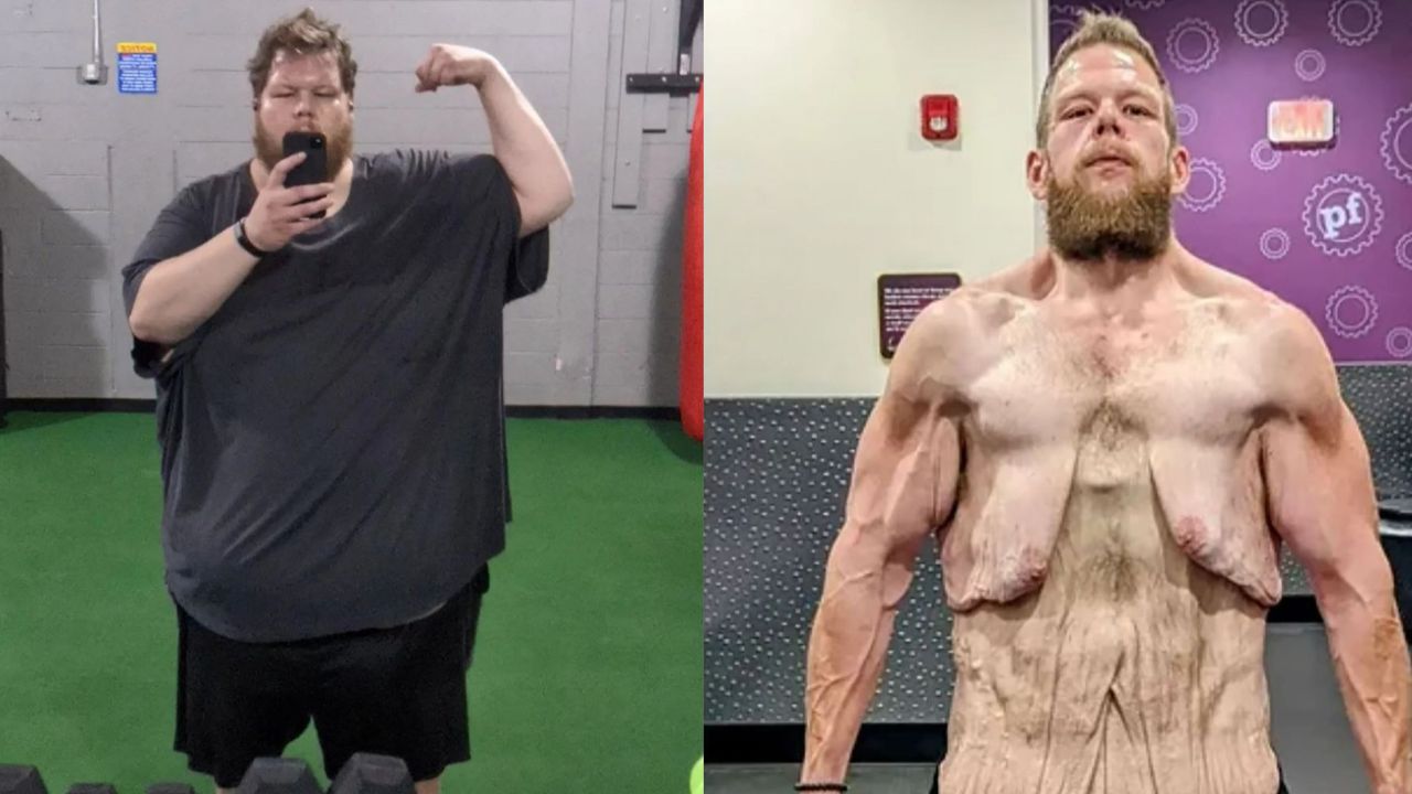Cole Prochaska underwent a massive weight loss of 336 pounds in less than two years. houseandwhips.com