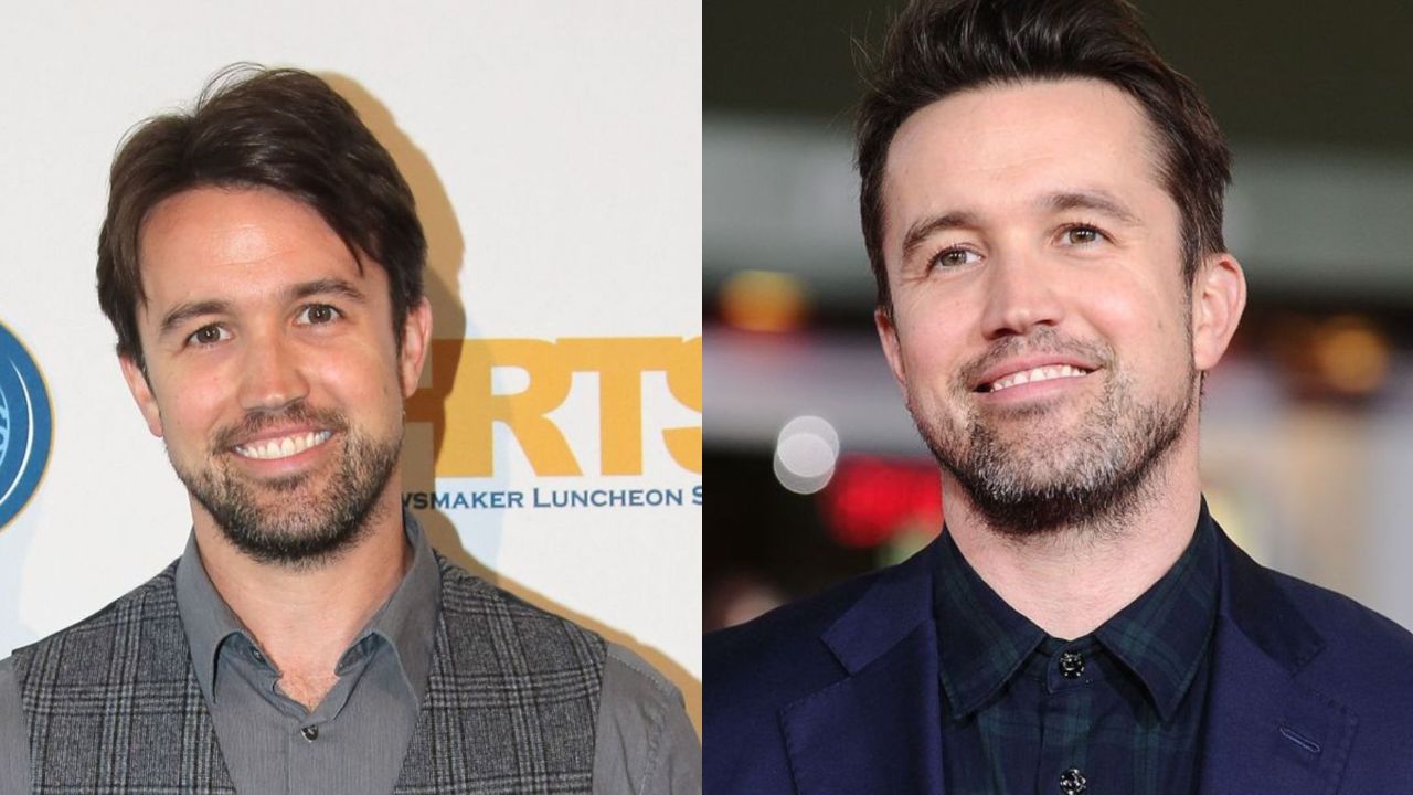 Rob McElhenney is suspected of getting plastic surgery including Botox and an eyelift. houseandwhips.com