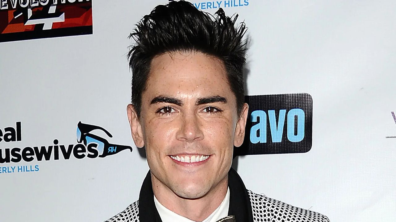 Tom Sandoval got Botox not on his forehead but above his ears. houseandwhips.com 