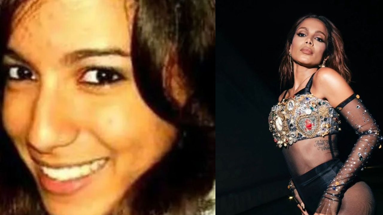 Anitta before and after plastic surgery. houseandwhips.com