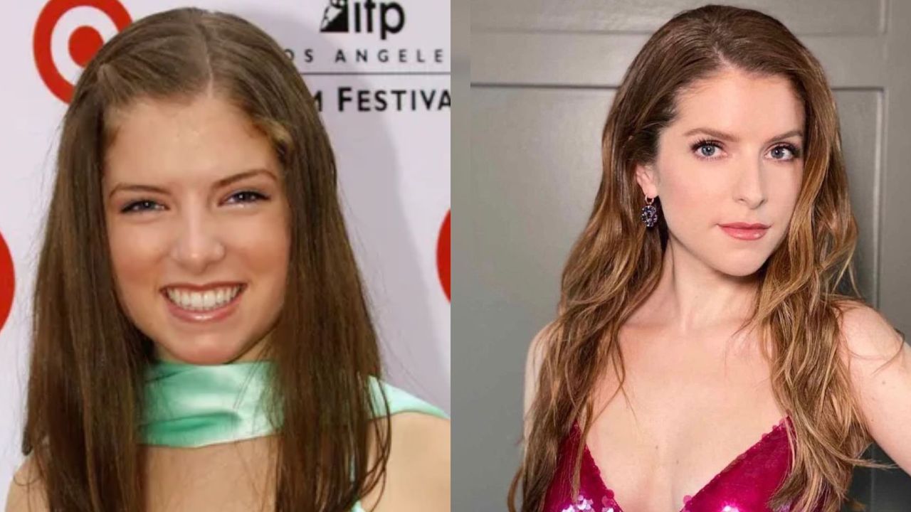 Anna Kendrick’s Plastic Surgery: What’s the Truth? houseandwhips.com
