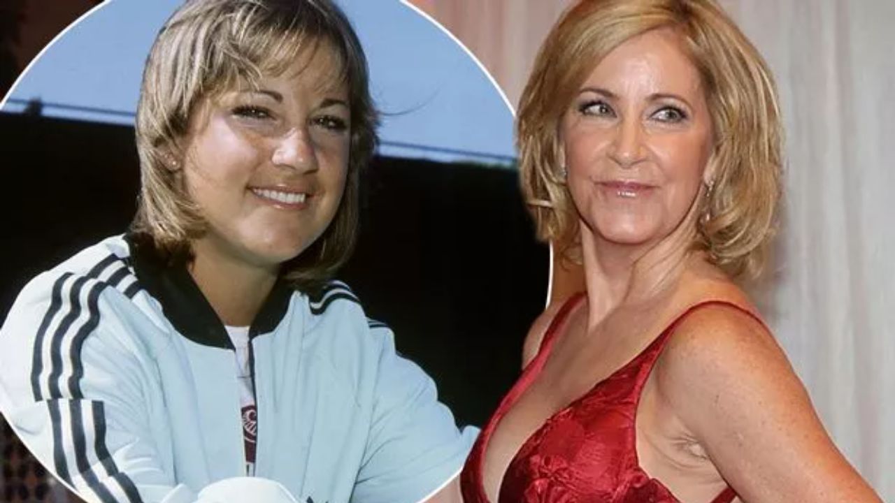 Chris Evert before and after plastic surgery. houseandwhips.com