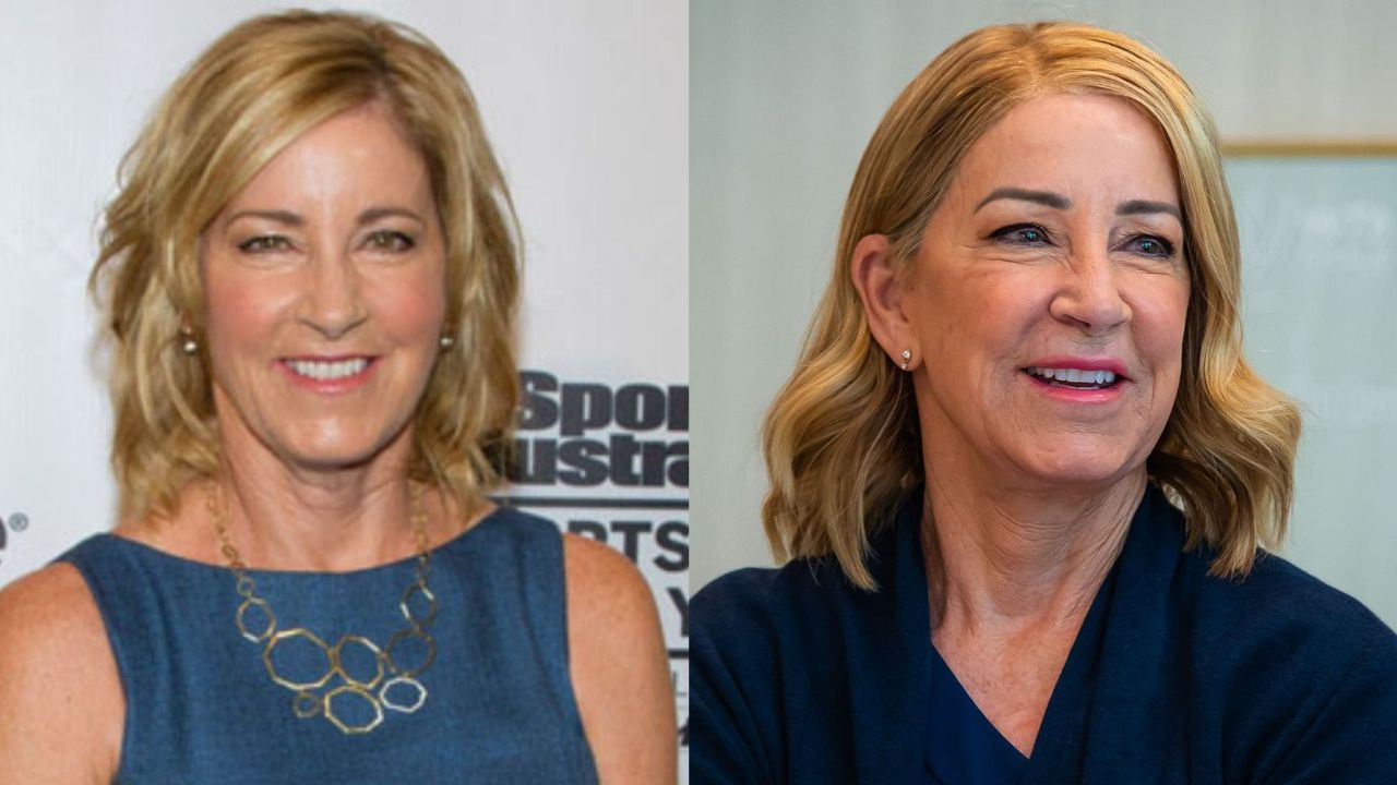 Chris Evert’s Plastic Surgery: Her New Look Examined! houseandwhips.com