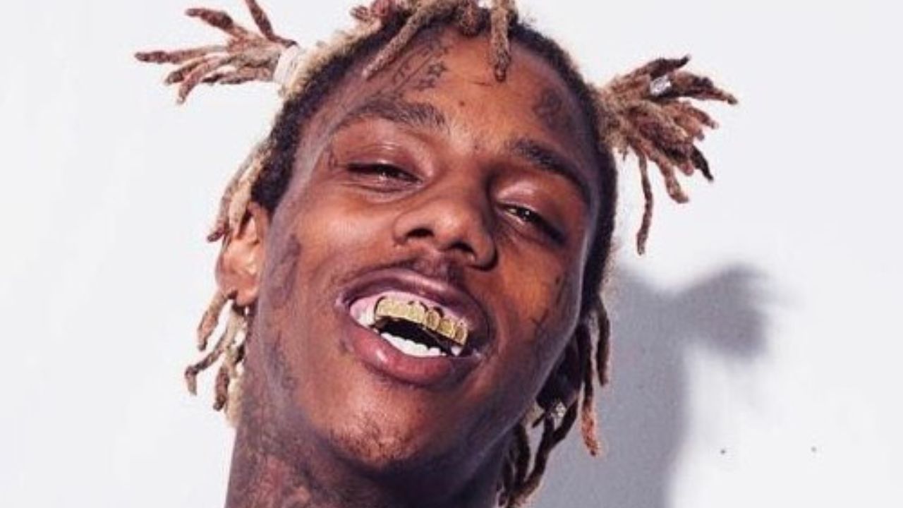 Famous Dex’s Teeth: What Is Wrong With Them? houseandwhips.com