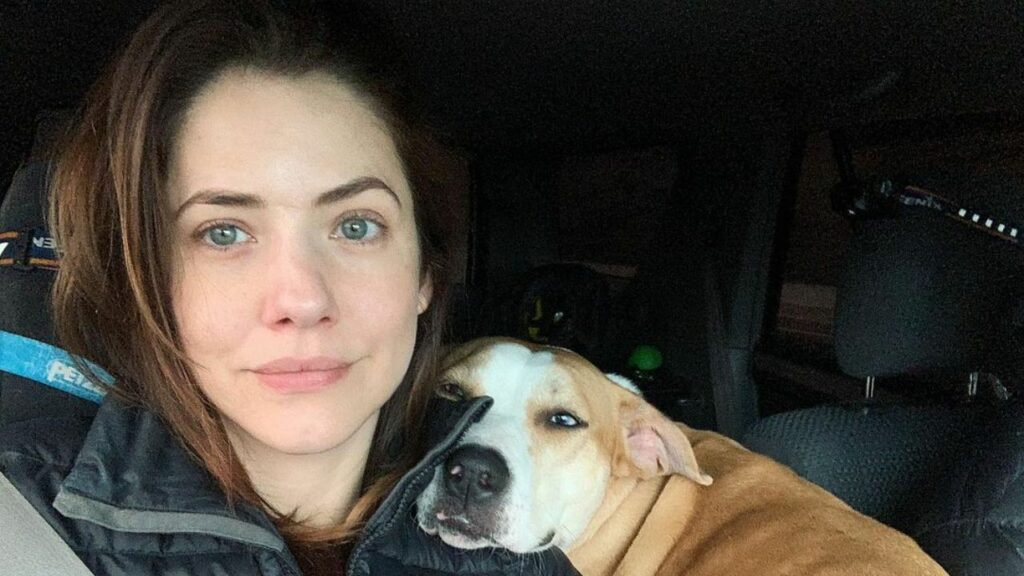Julie Gonzalo’s Scar Birth Mark or What?