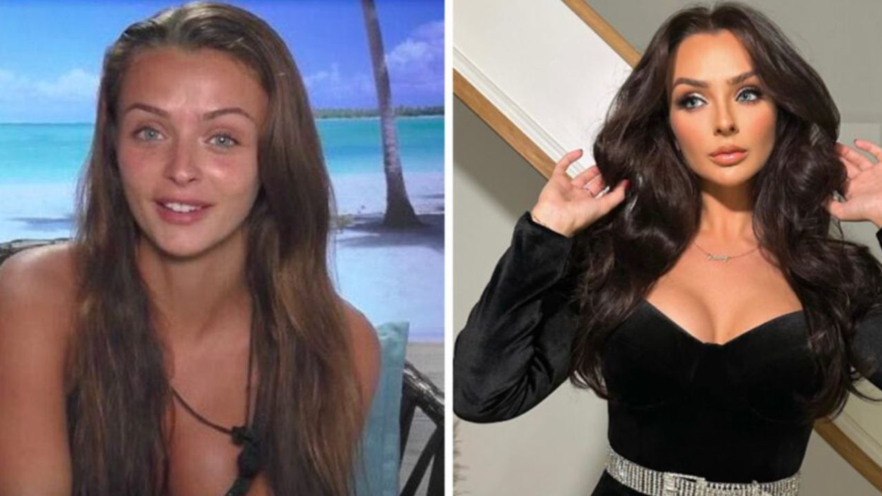 Kady McDermott before and after plastic surgery. houseandwhips.com