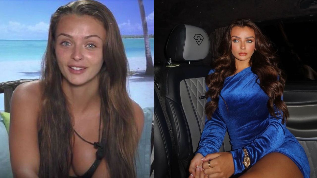 Kady McDermott’s Plastic Surgery: Before and After Pictures Examined! houseandwhips.com