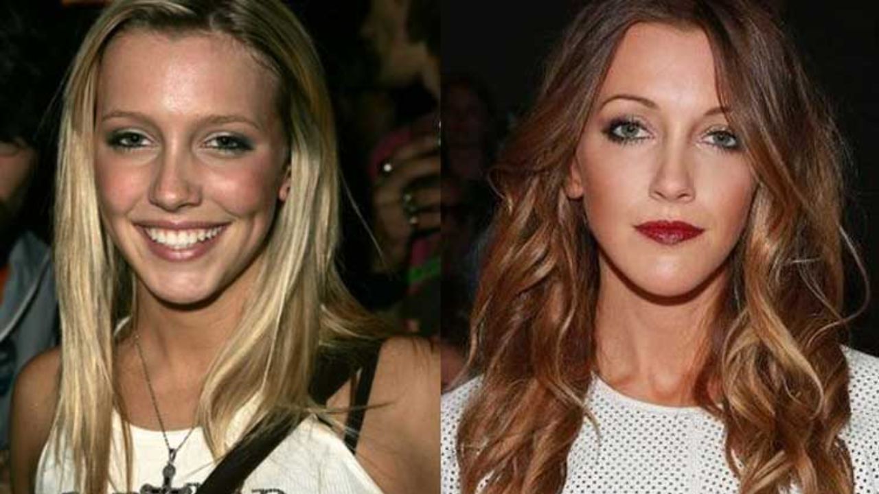 Katie Cassidy before and after plastic surgery. houseandwhips.com