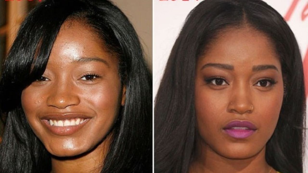 Keke Palmer before and after plastic surgery. houseandwhips.com