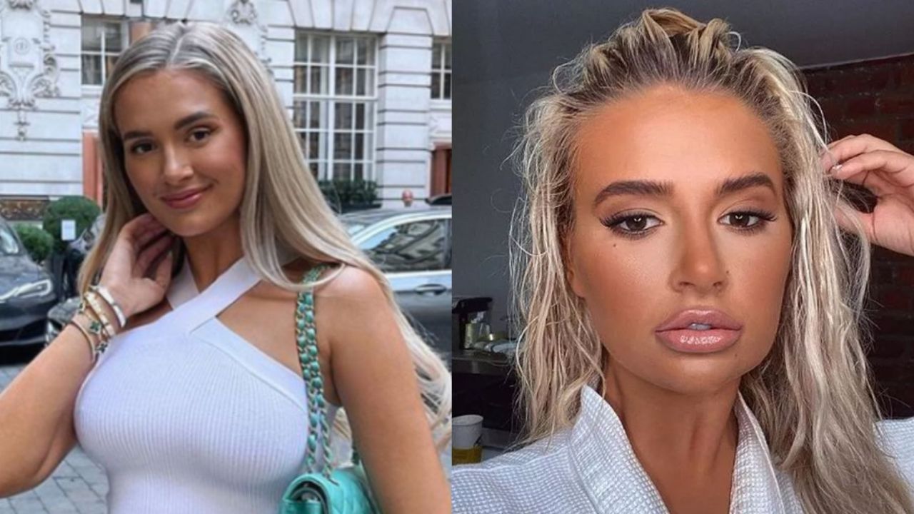 Molly Mae reversed her plastic surgery because she felt horrendous about her fillers. houseandwhips.com