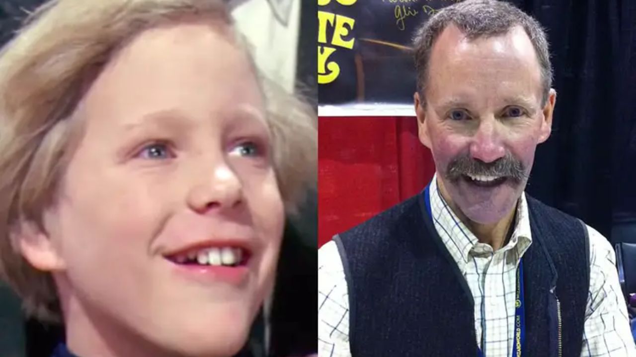 Before and after teeth of Peter Ostrum. houseandwhips.com