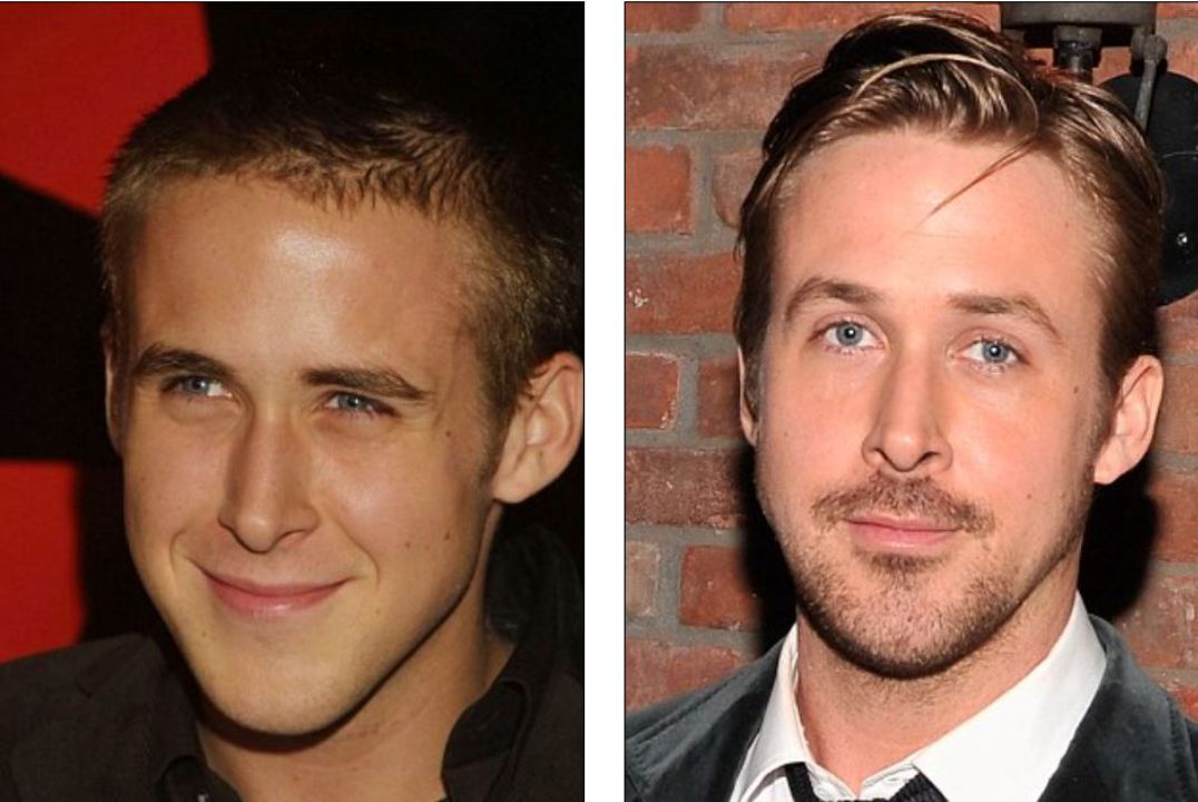 Ryan Gosling before and after a nose job. houseandwhips.com