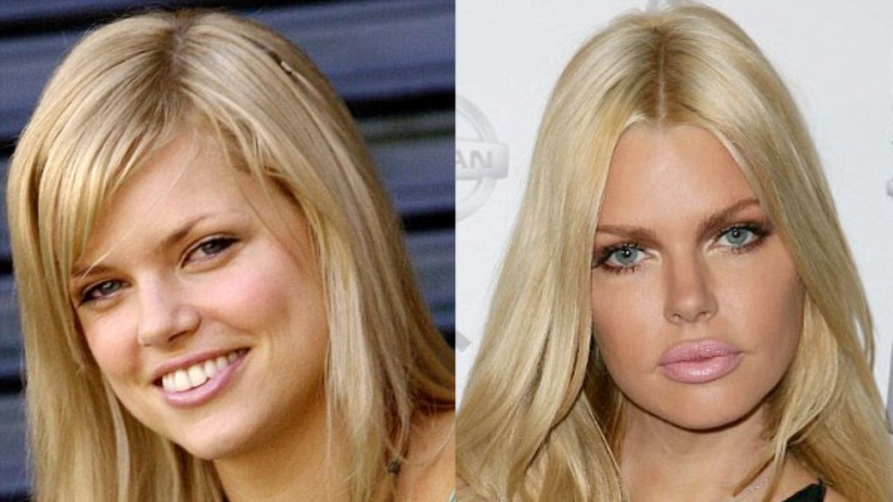 Sophie Monk before and after plastic surgery. houseandwhips.com