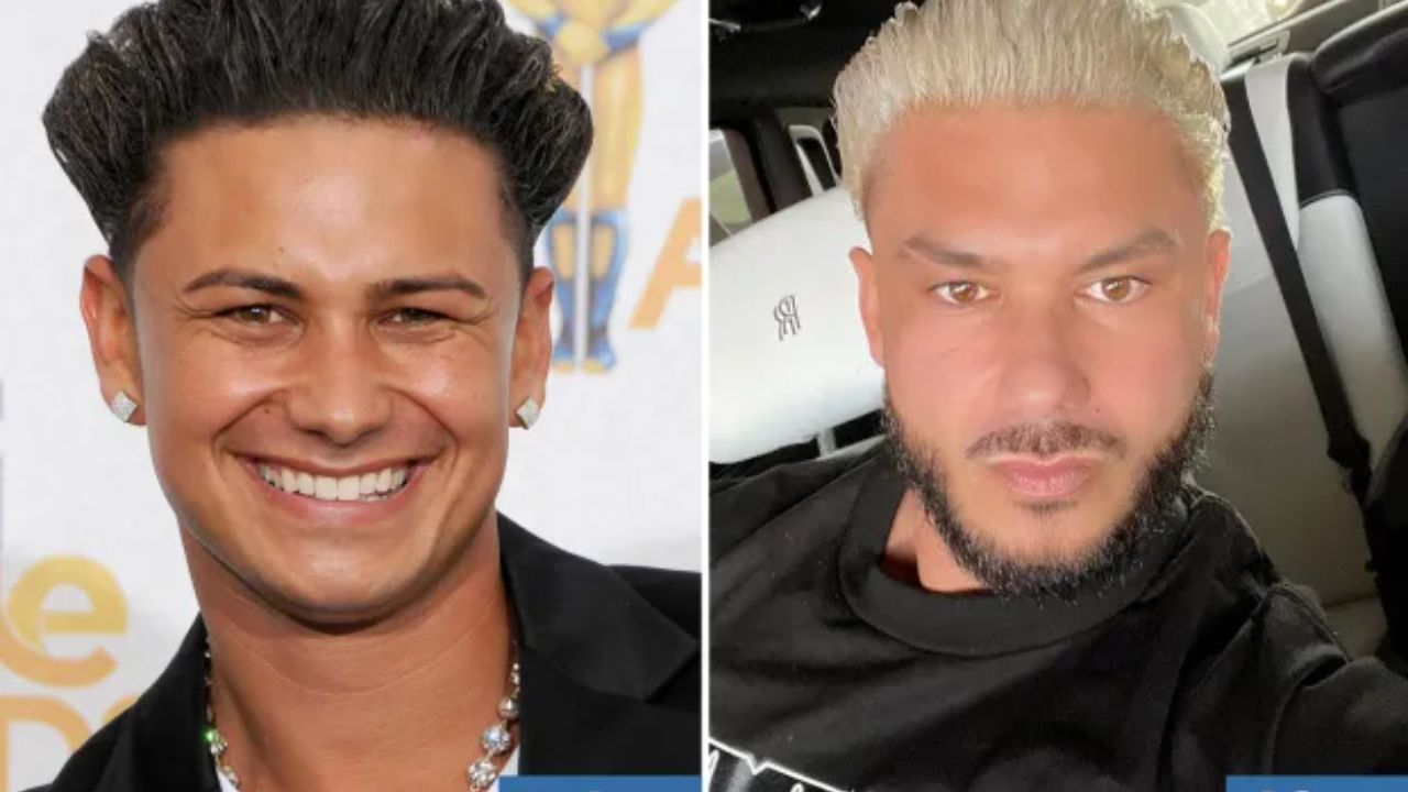 DJ Pauly D supposedly had an upper eyelid lift and Botox. houseandwhips.com