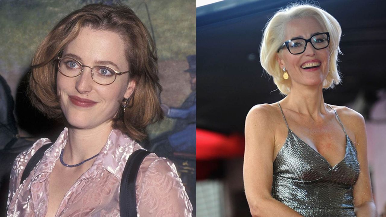 Did Gillian Anderson Have Plastic Surgery? Then and Now Pictures Examined! houseandwhips.com