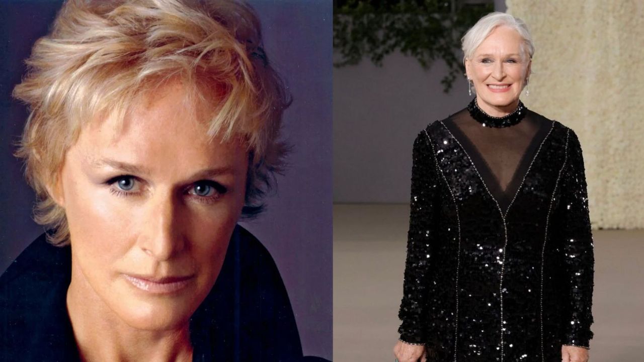 Glenn Close before and after plastic surgery.