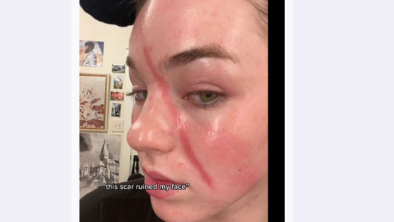 Jentri Wallace’s Scar: What Happened to Her Face? Was It an Accident? houseandwhips.com